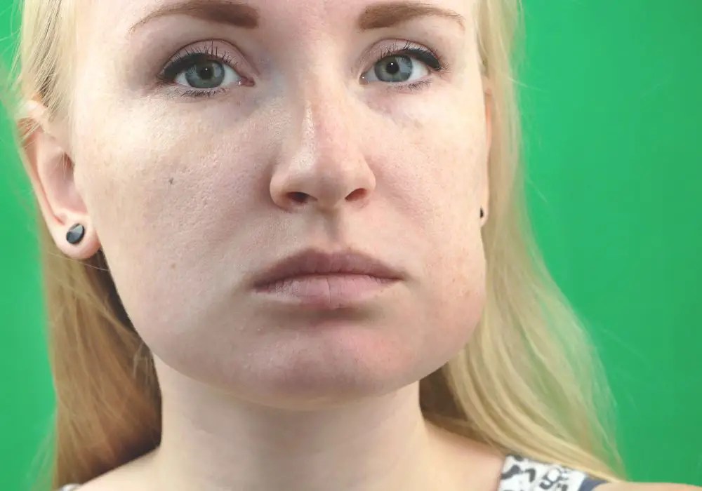 Why is my gum between my teeth and cheek swollen? (Causes & Solutions)