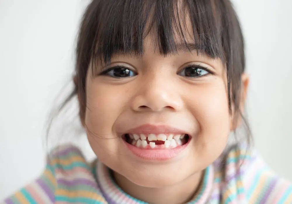 Do All Milk Teeth Go Away? Everything You Need to Know