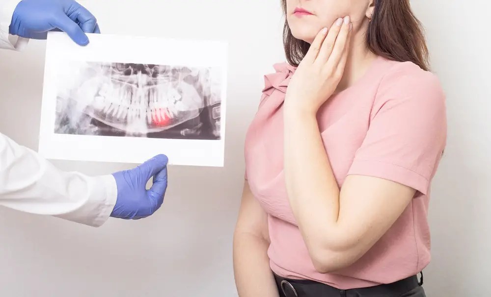 When to Get Your Wisdom Teeth Removed A Guide to Timing and Considerations