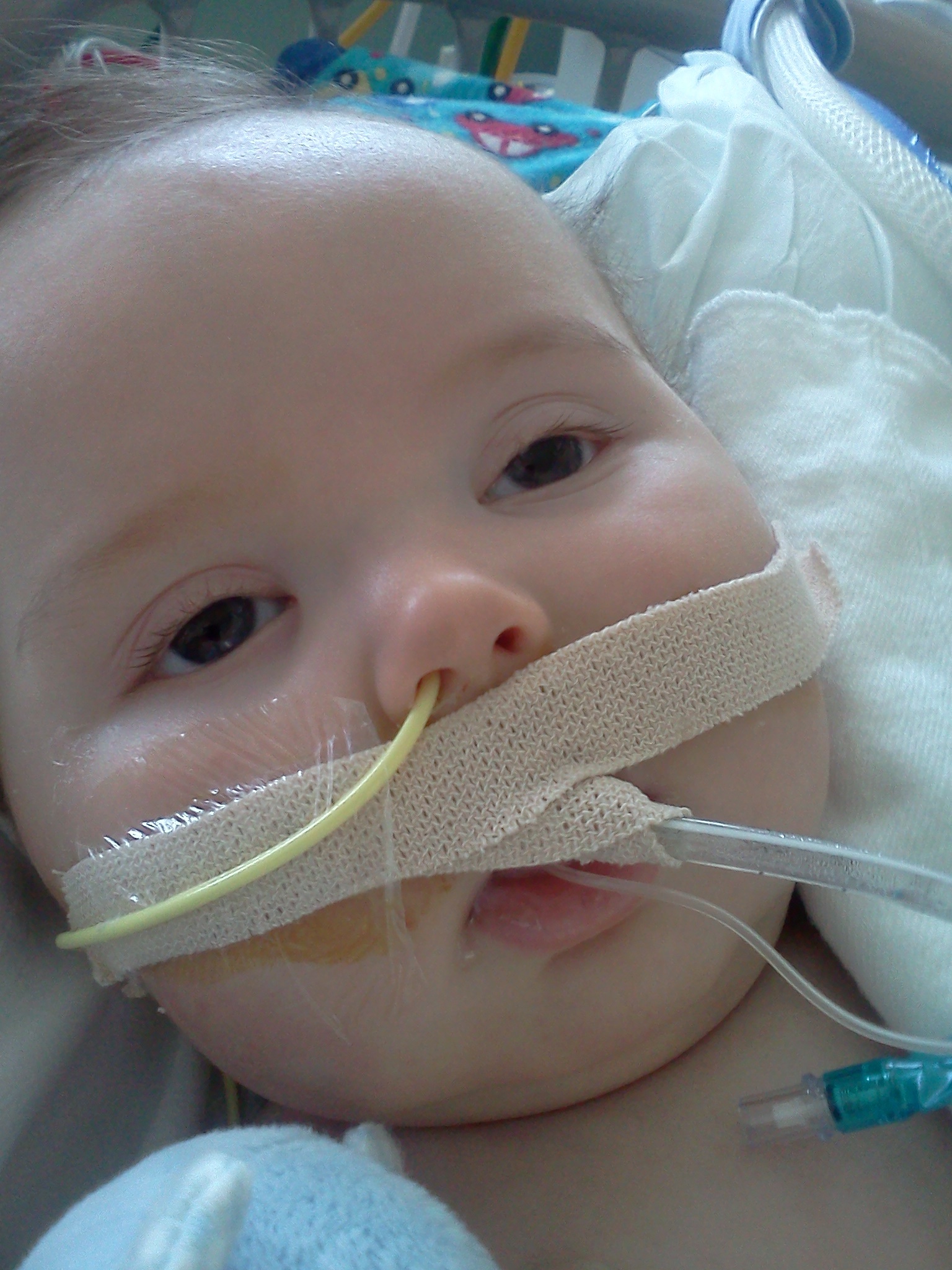 Infant Botulism Treatment and Prevention Program BabyBIG