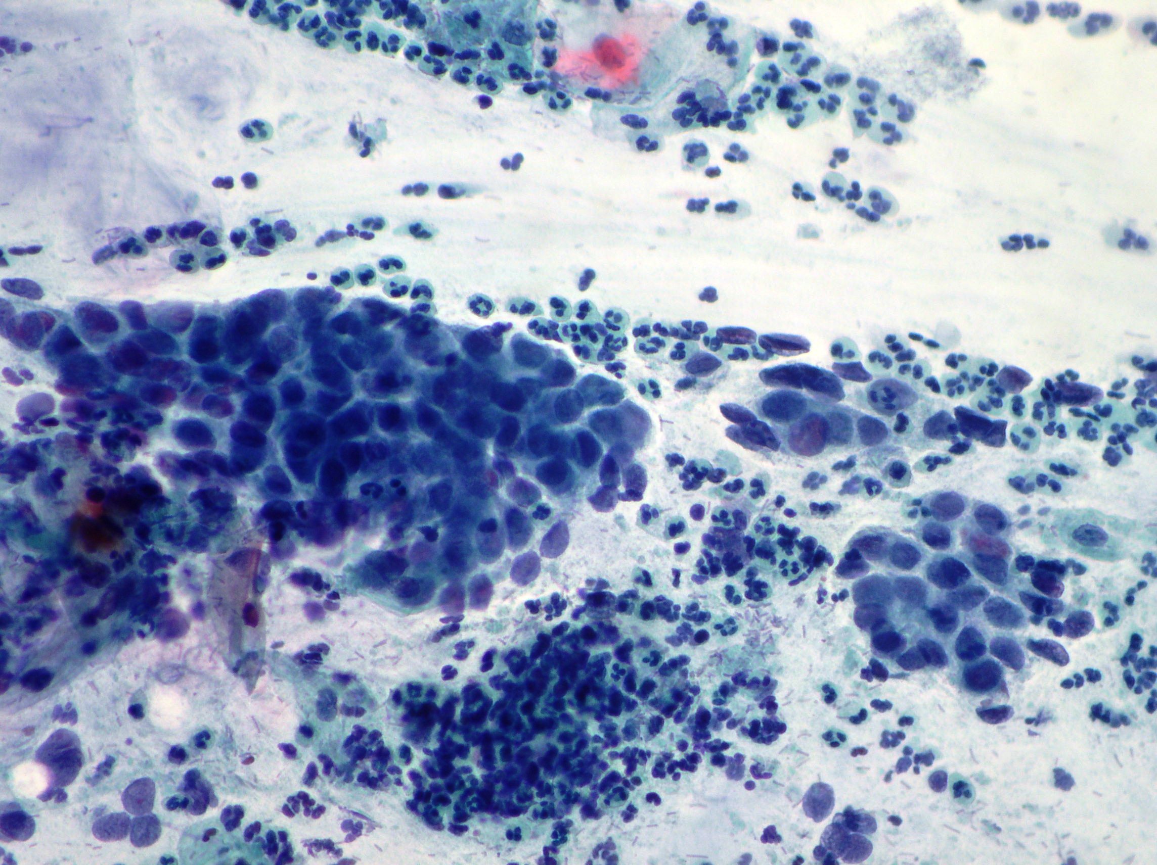 Uterine Cervix Cytopathology