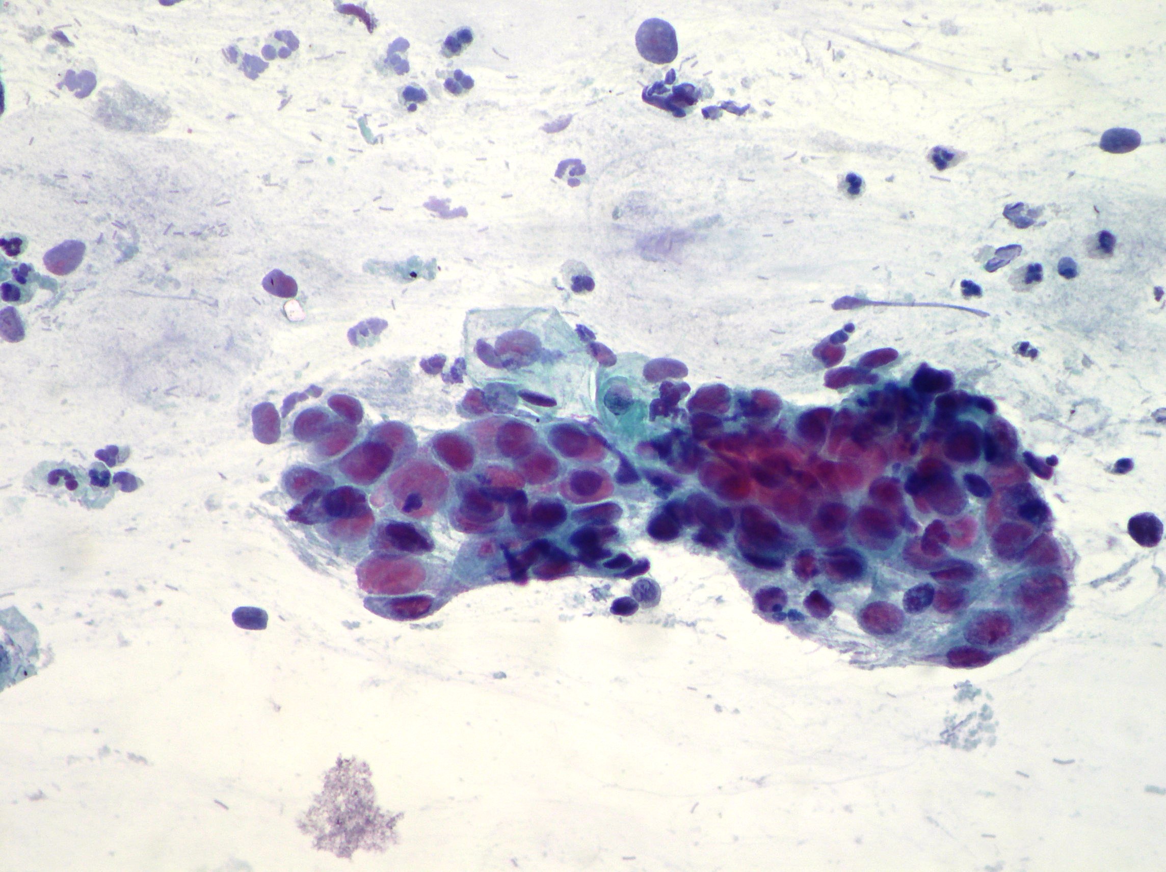 Uterine Cervix Cytopathology
