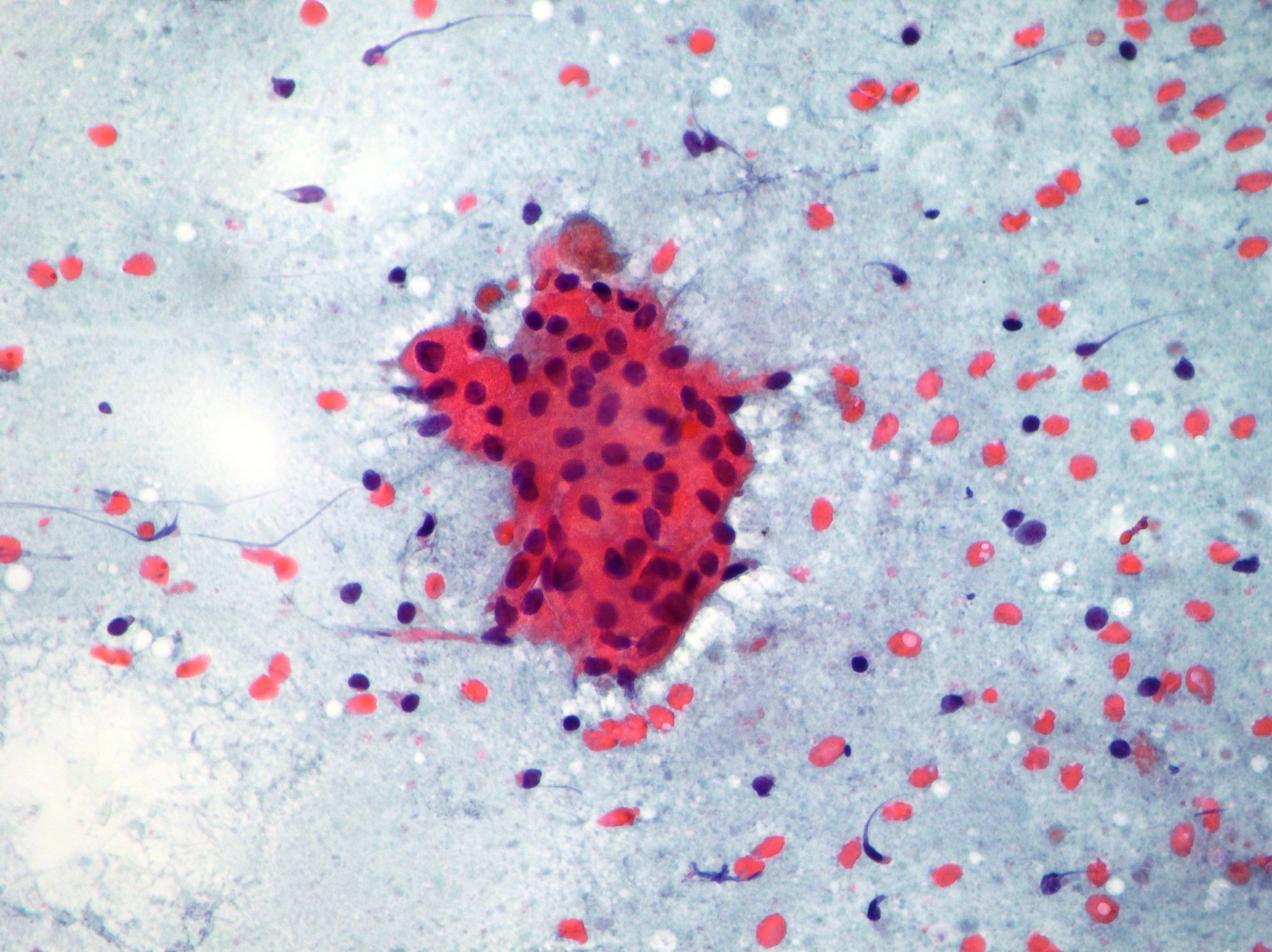 Salivary Glands Cytopathology