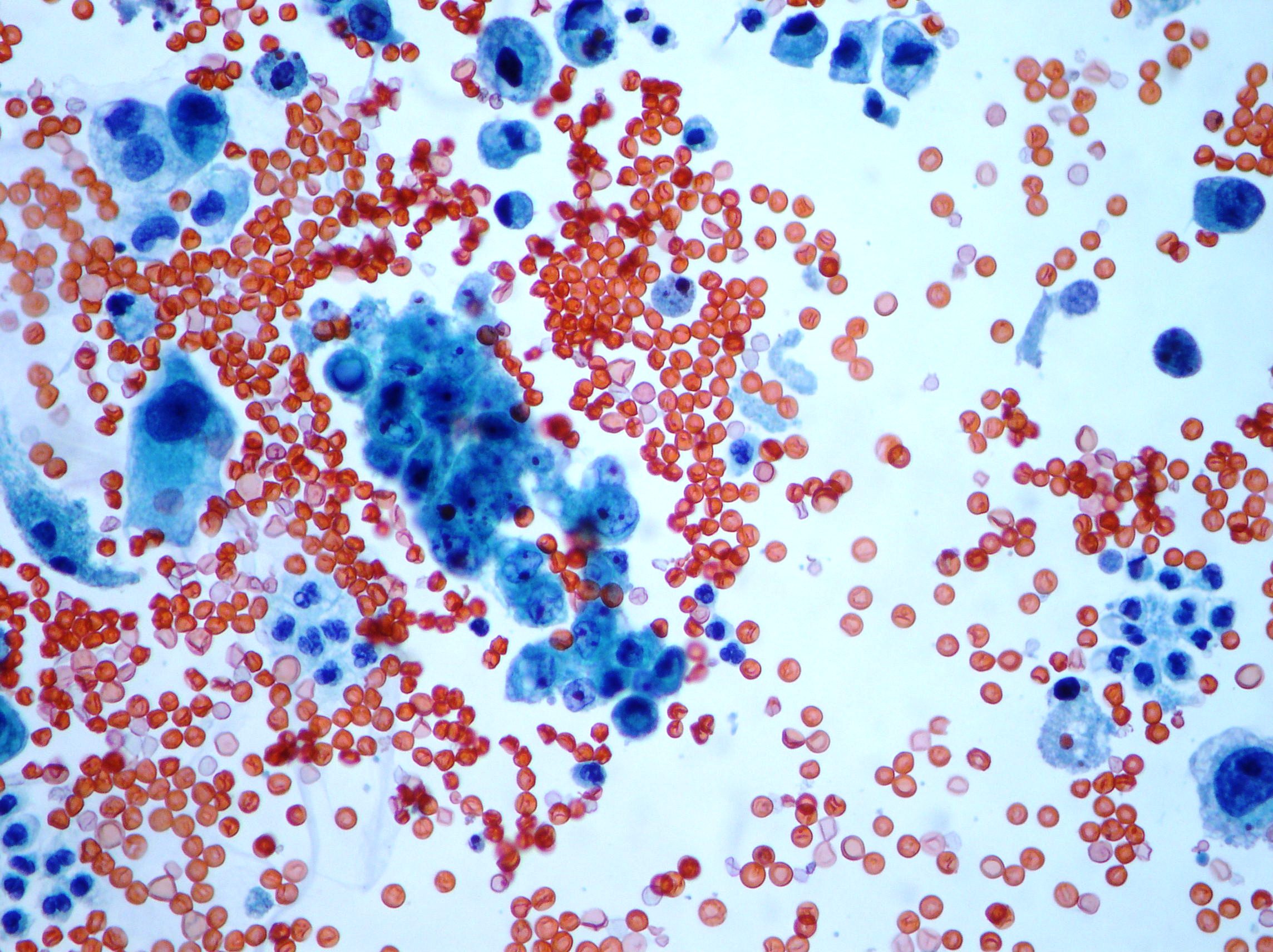 Urinary Cytopathology