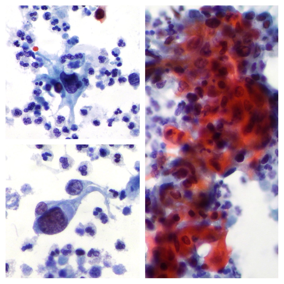 Urinary Cytopathology
