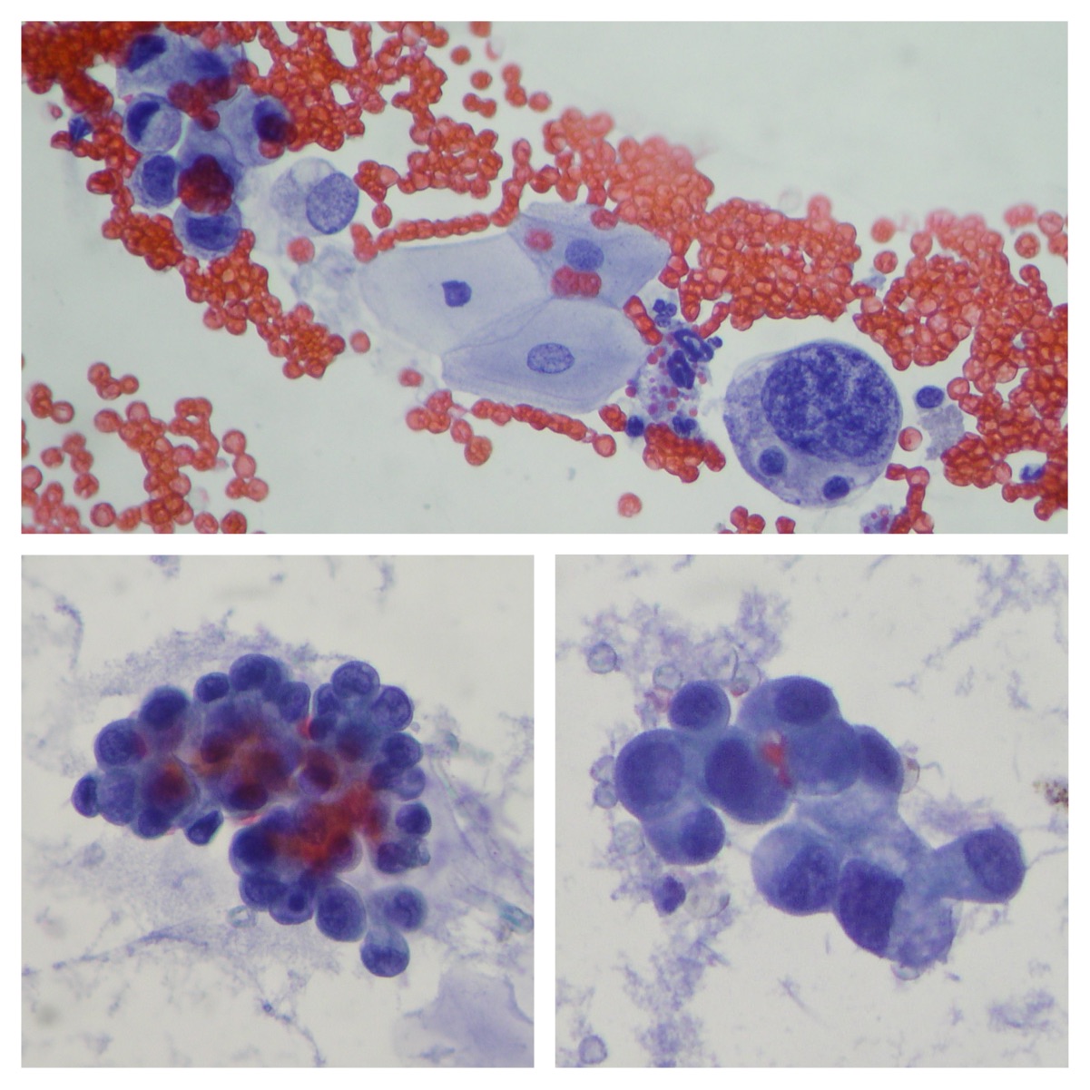 Urinary Cytopathology