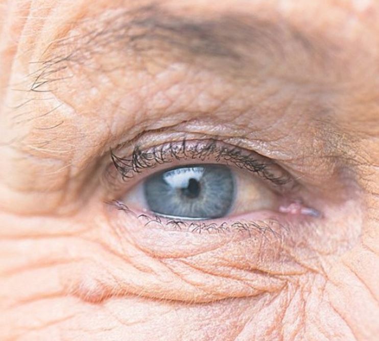 Cirugía de catarata, mejor operar cuanto antes Central Ocular Clínica