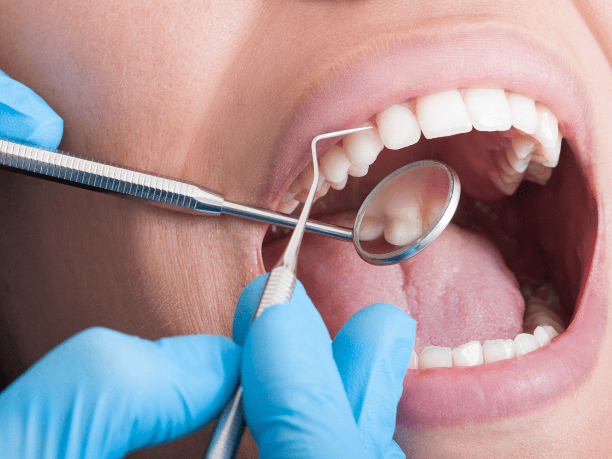 The Importance of Regular Teeth Cleanings Centrasota Dental