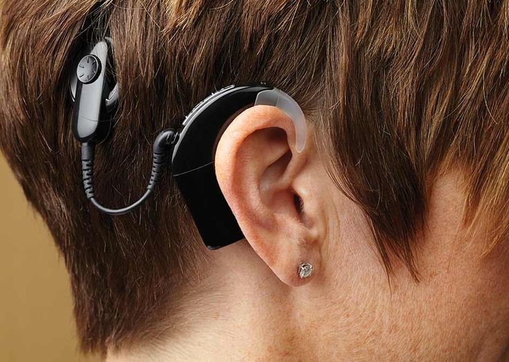 Cochlear Implant Device