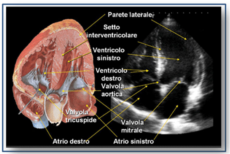 Elettrocardiogramma ed Ecocardiogramma esami diversi ma complementari Elettrocardiogramma ed Ecocardiogramma esami diversi ma complementari