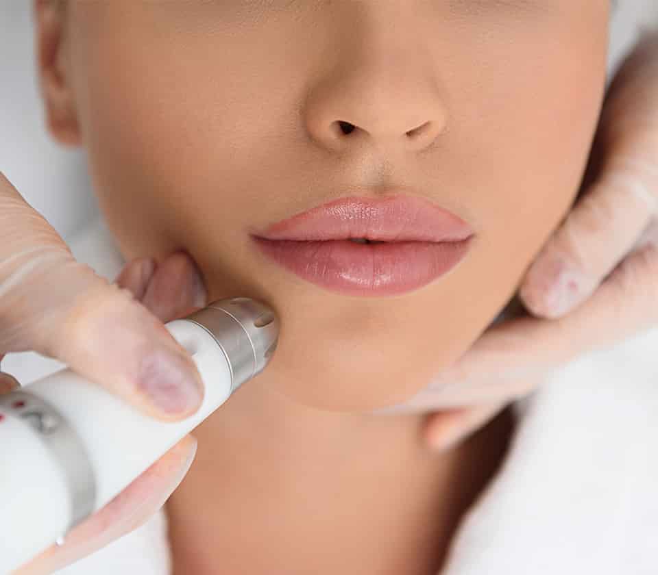 Laser Resurfacing Charmed Medispa