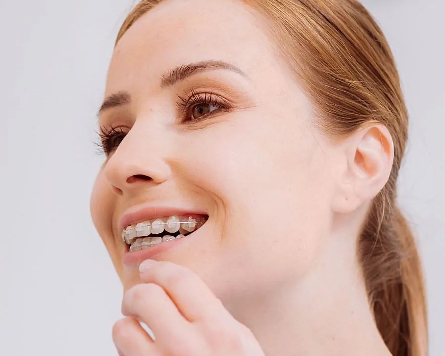 How Do Damon Braces Work To Fix Your Smile Using New Technology Chart