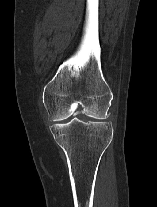 Orthopaedic (MSK) CT Charter Radiology