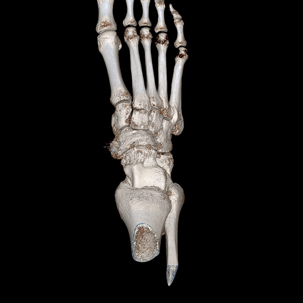 Orthopaedic (MSK) CT Charter Radiology