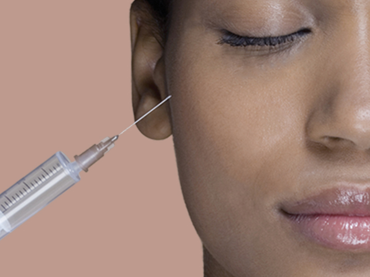 Dermal fillers for acne scars What you need to know (including cost)