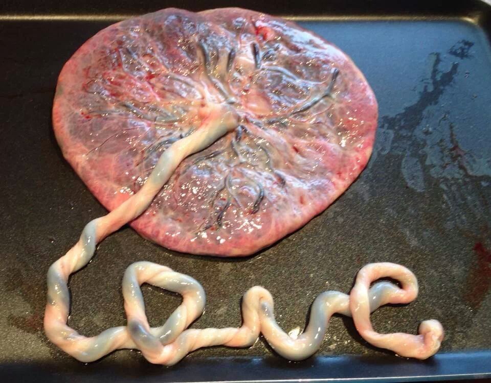 ¿Qué es la placenta y cómo funciona? Mi sitio