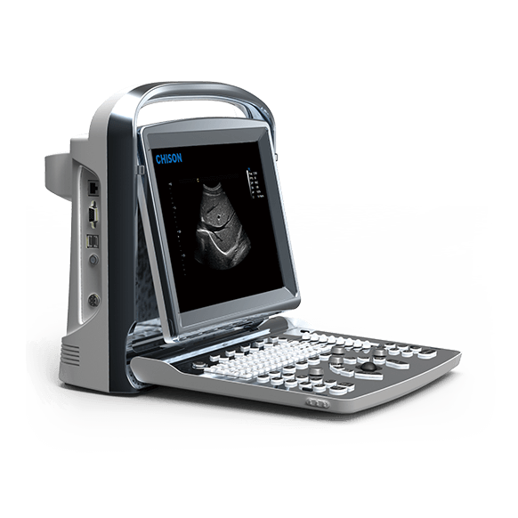 ECO Portable Ultrasound Machine