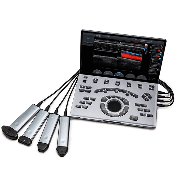 Portable Ultrasound Machine SonoAir