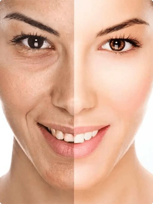 Best Hyperpigmentation Treatment in Luquillo, Puerto Rico Chi Spa