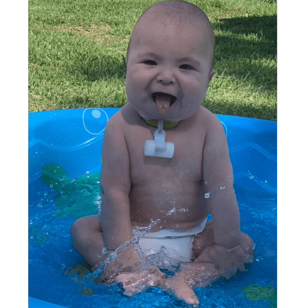 Brayden's kidney journey how this 4yearold has defied all odds