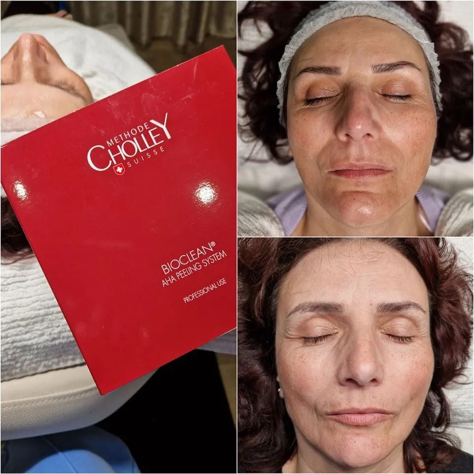 Exfoliating Peel Off Face Mask for Glowing Skin CHOLLEY