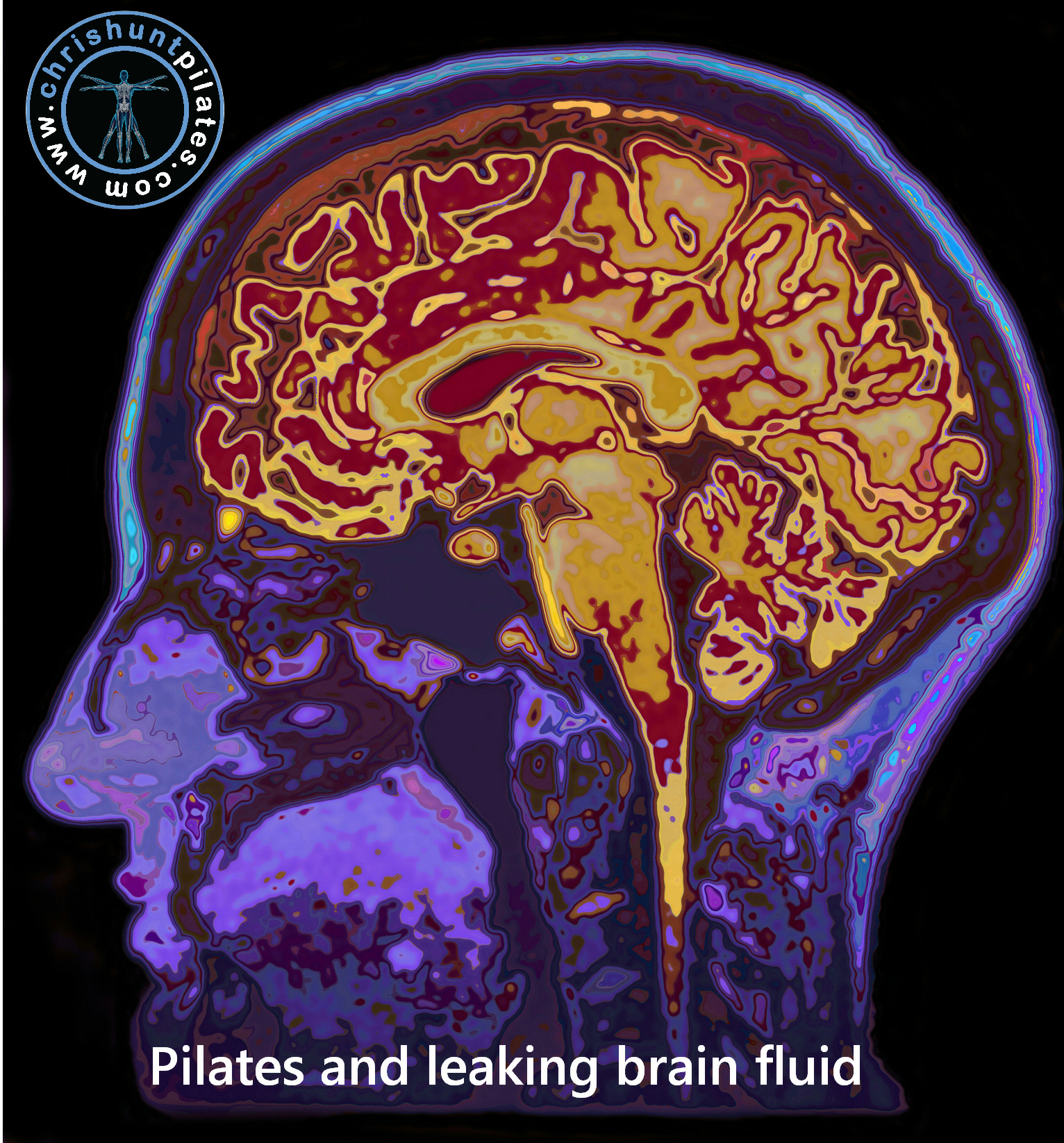 Chris Hunt Wellness — Pilates and leaking brain fluid