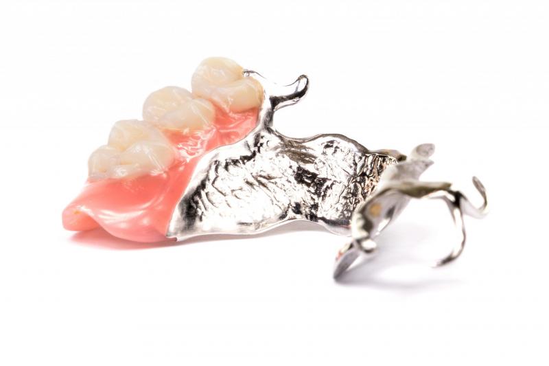 Prothèse dentaire squelettique Chrome Labor SPRL