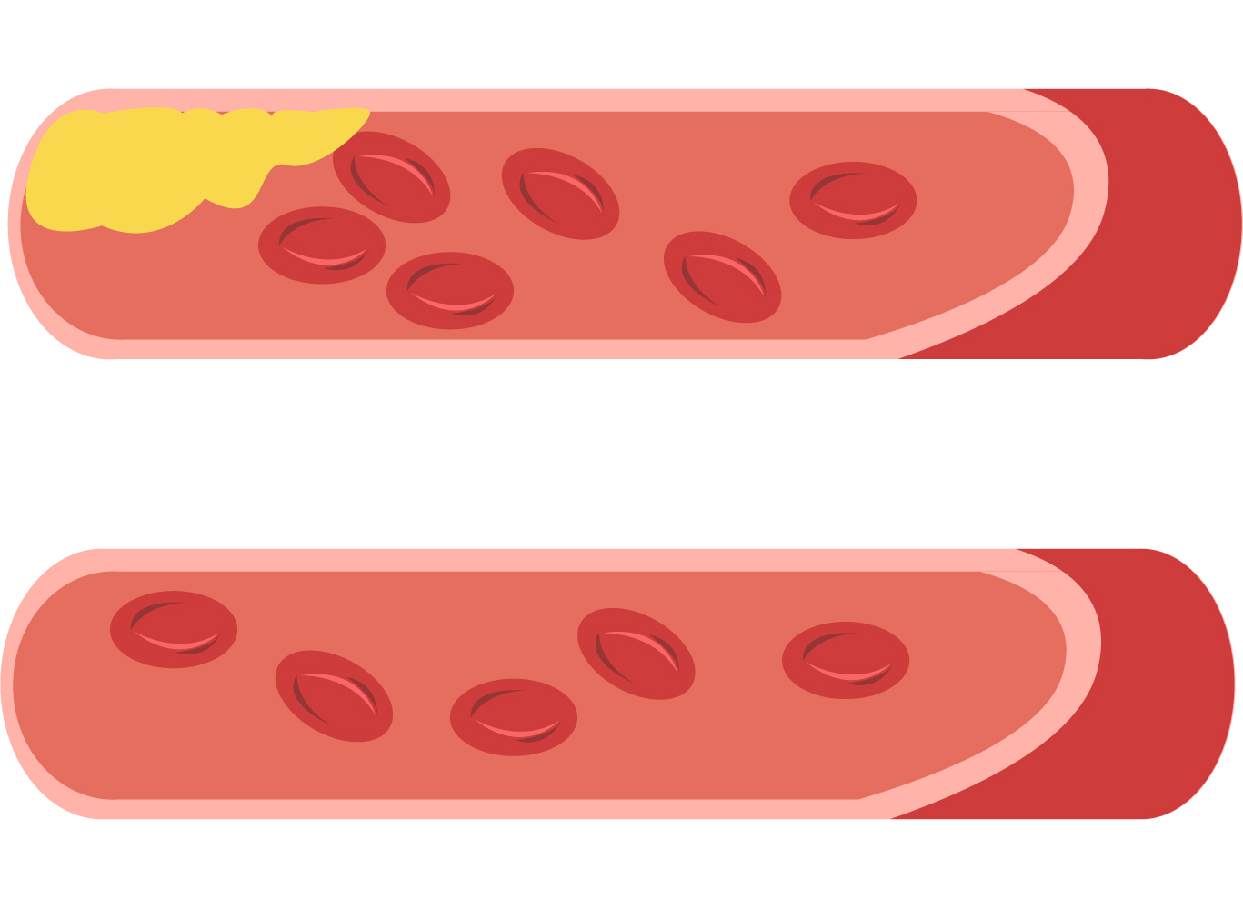 コレステロールと中性脂肪の関係 中性脂肪Navi