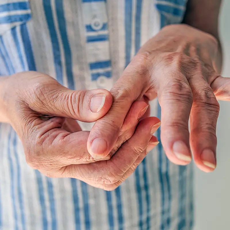 Treating Arthritis/Osteoarthritis at Cima Health