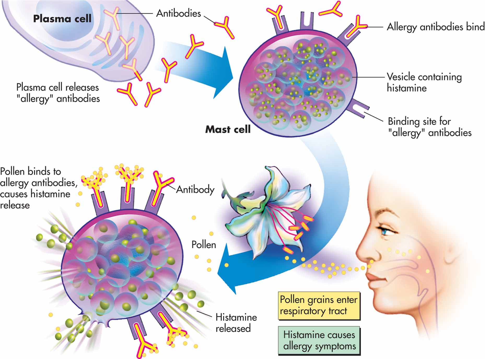 What Is Allergic Rhinitis?