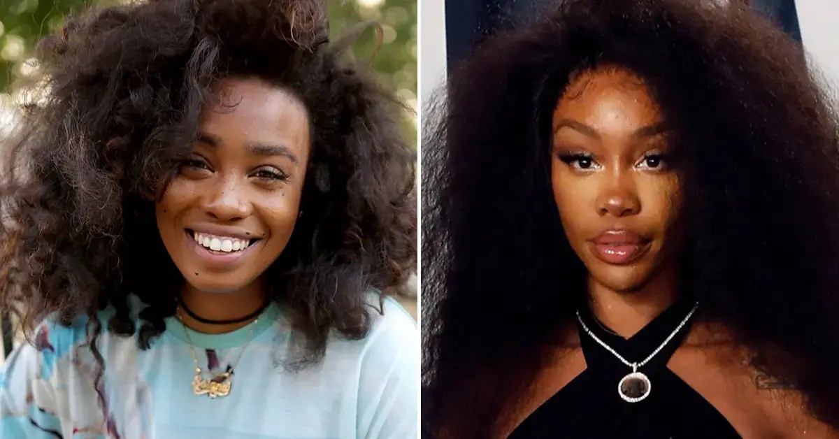 Did SZA Undergo Plastic Surgery? Unveiling the Truth Behind the Plastic