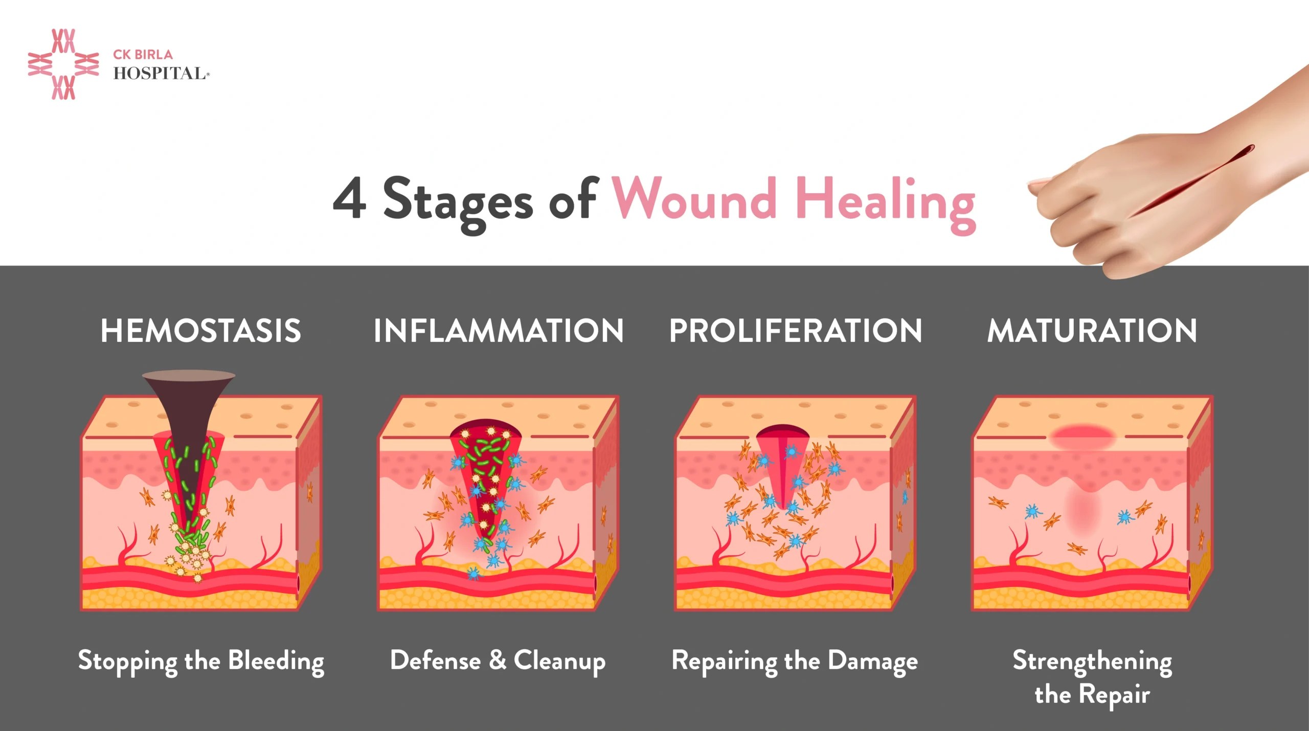 Wound Healing Steps Stages Of Skin Healing Top 4 Crucial Steps For