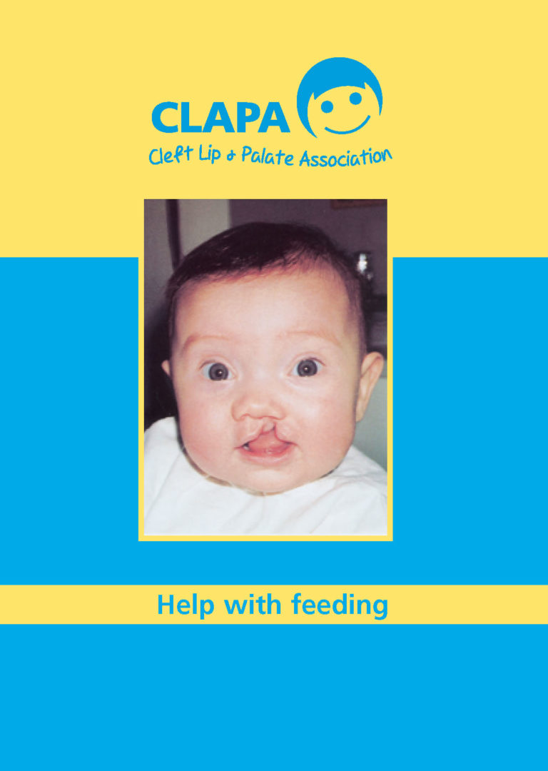 Cleft Lip & Palate Association