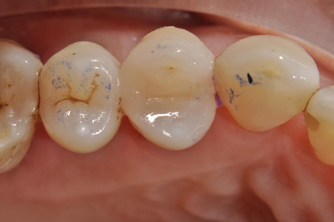 Case313 Tam Dental Group