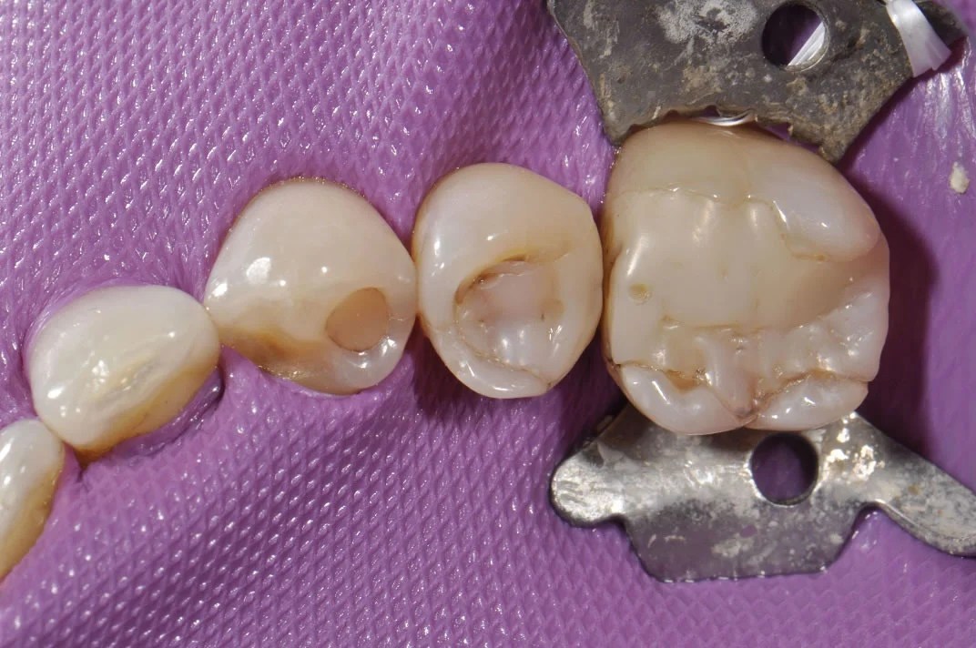 Case317 Tam Dental Group
