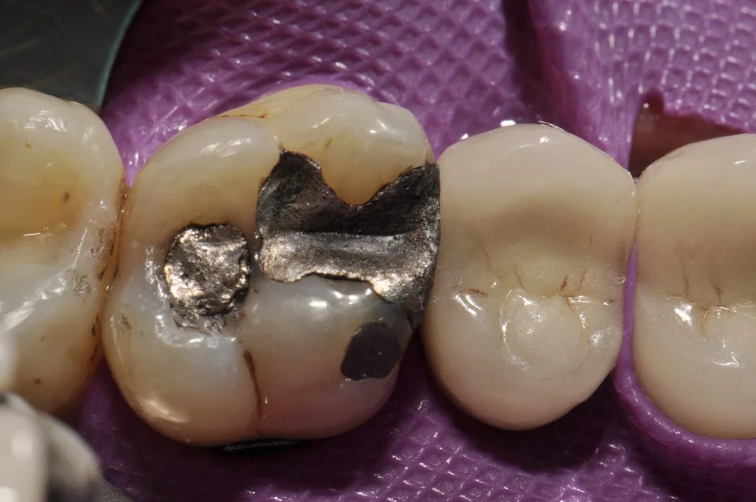 Case348 Tam Dental Group
