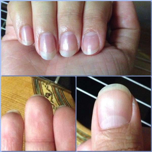 Classical Guitar Fingernails