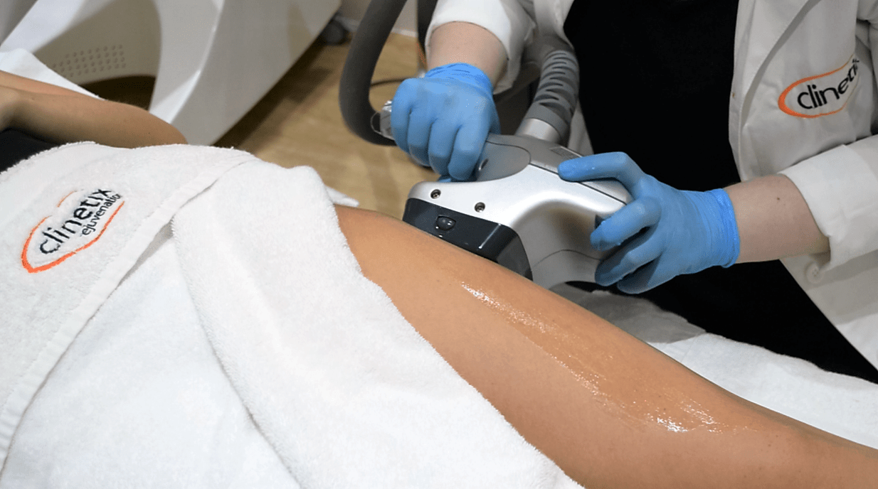 Top Tips To Prepare for Velashape Body Contouring Glasgow, Scotland