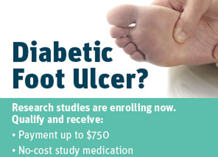 Diabetic Foot Ulcers Newark NJ (Clinical Trial 31919)