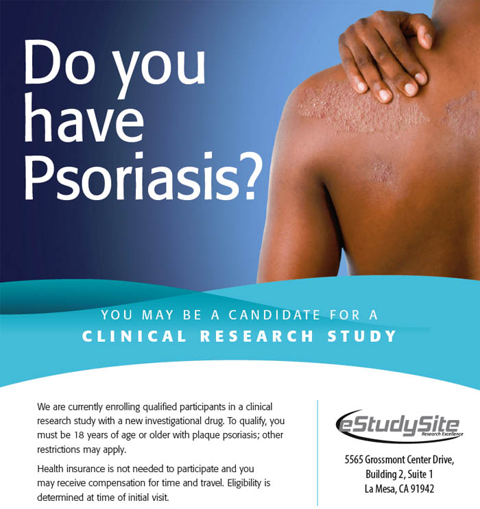 Psoriasis San Diego CA (Clinical Trial 34134)