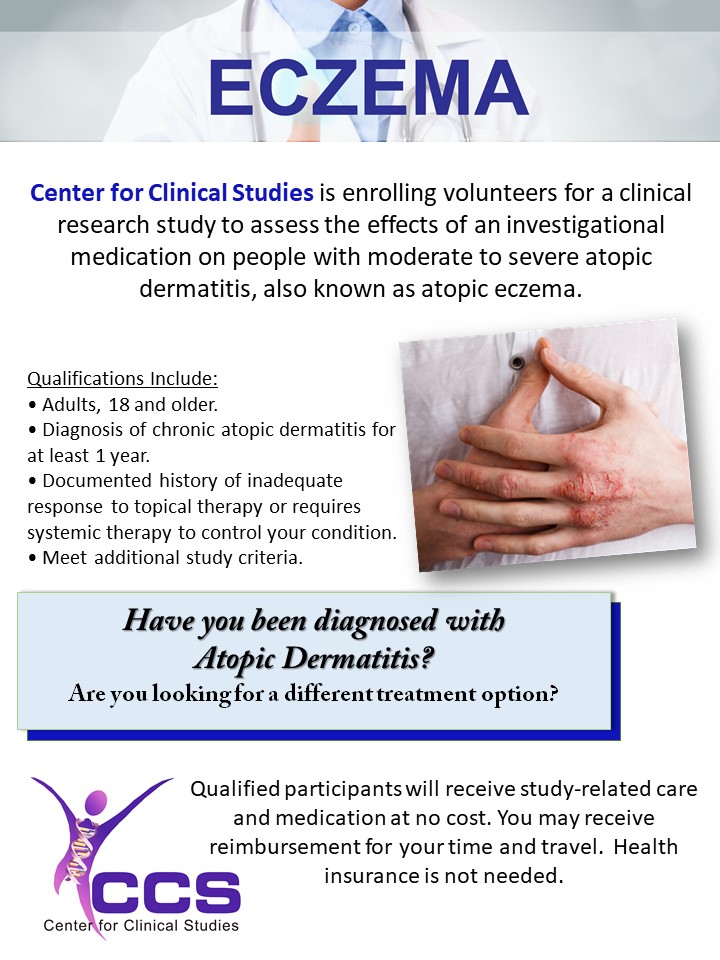 Eczema (Atopic Dermatitis) Houston TX (Clinical Trial