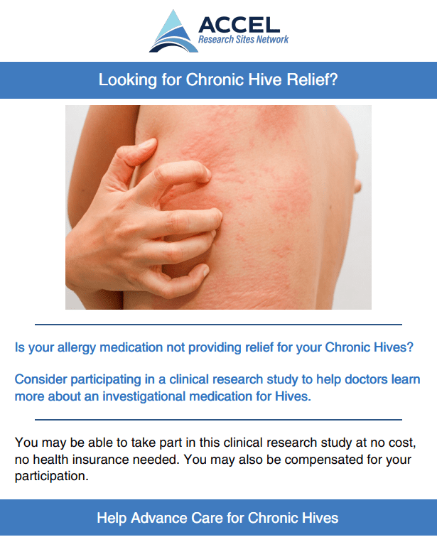 Chronic Hives Maitland FL (Metro Orlando) (Clinical Trial 49915)
