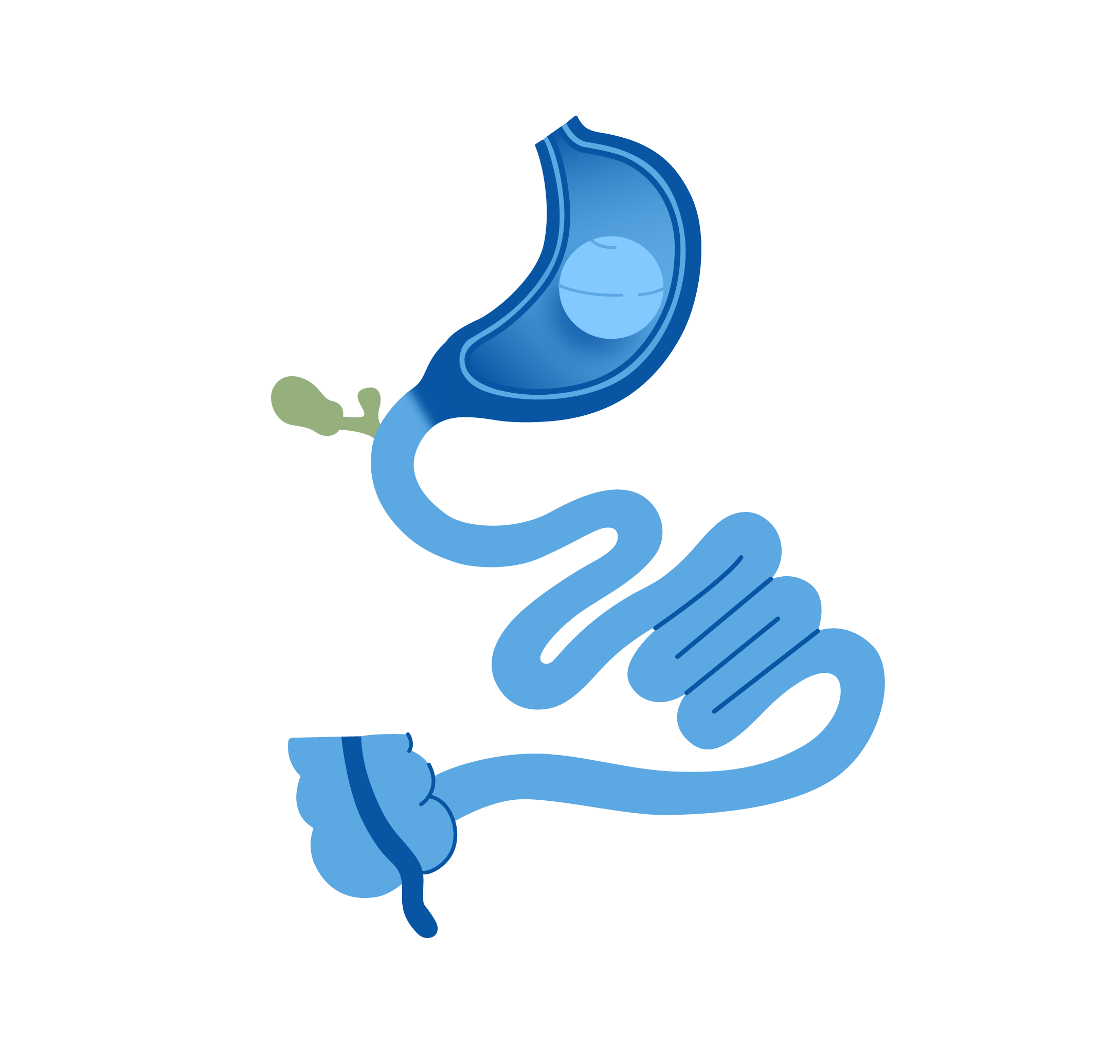 Balón Endoscópico • Clínicas Obésitas