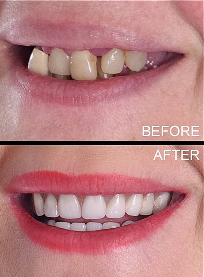 Clove Dental, Muscatine Dentist, Cosmetic and Family Dentistry