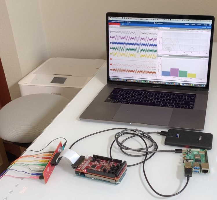 HackEEG Arduino Shield Reads Signals from Your Brain (EEG), Muscles