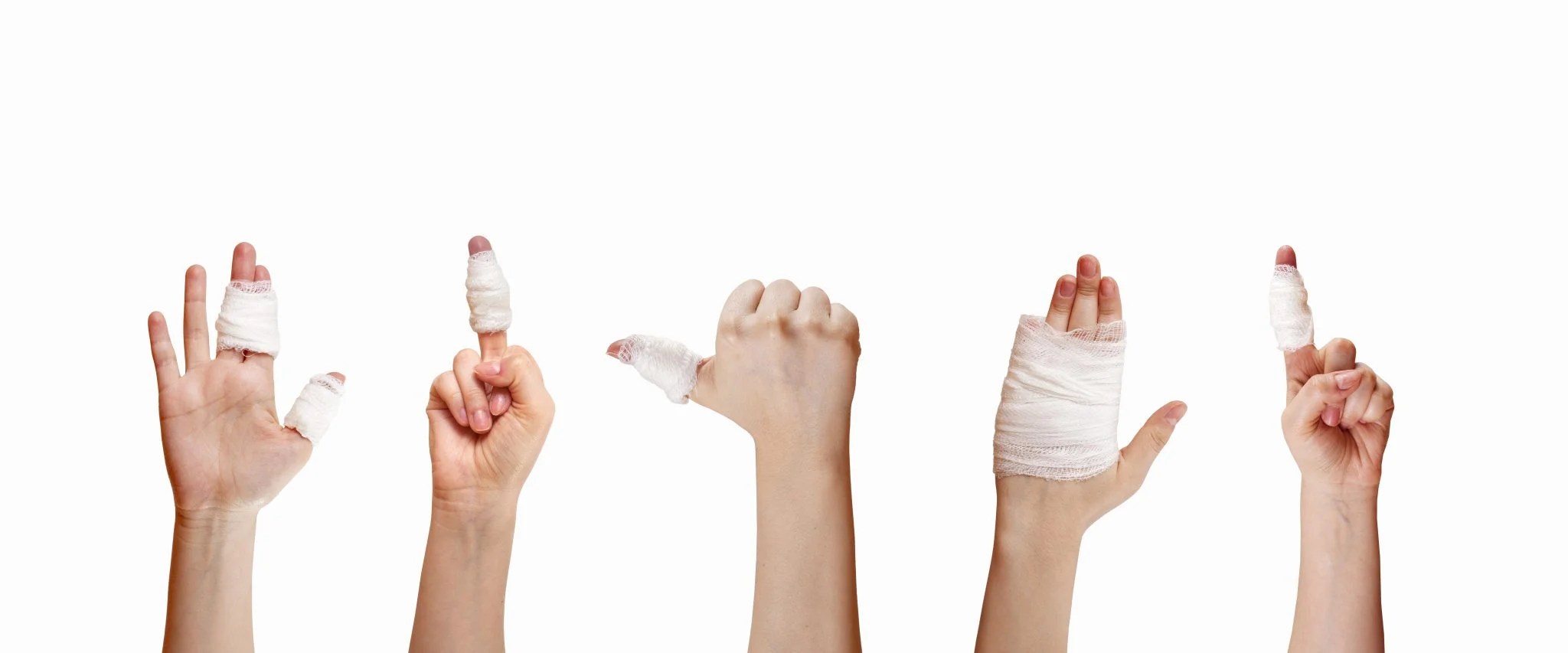 It's not just a "jarred" finger! Central Coast Physiotherapy