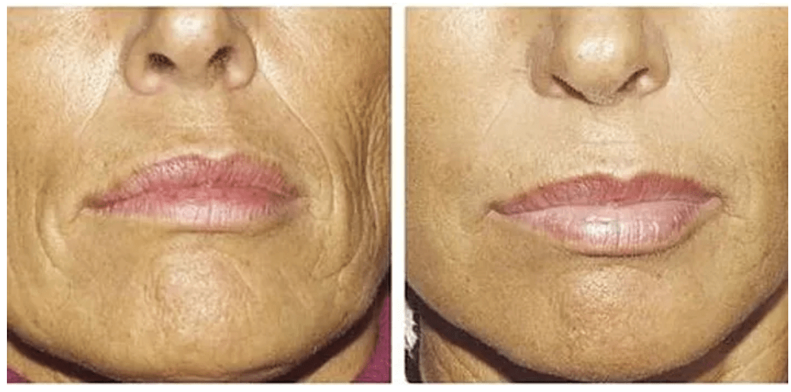 Red Light Therapy Cocoa Tanning Studio