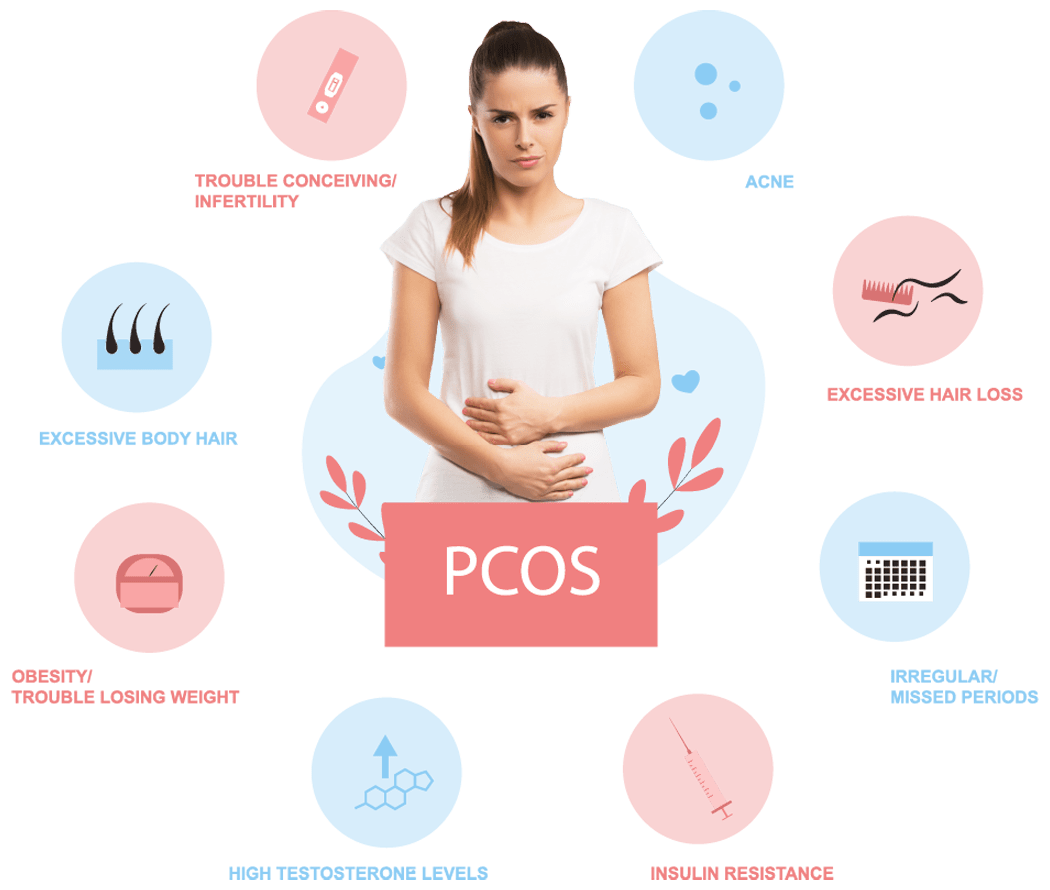 PCOS and Laser Hair Removal Everything You Need to Know