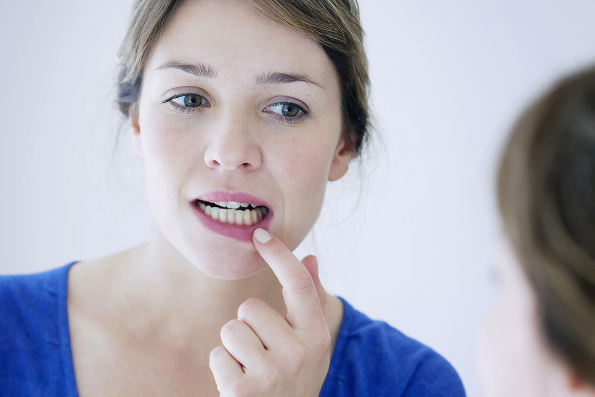 receding gums Tag Archives Columbia Smiles