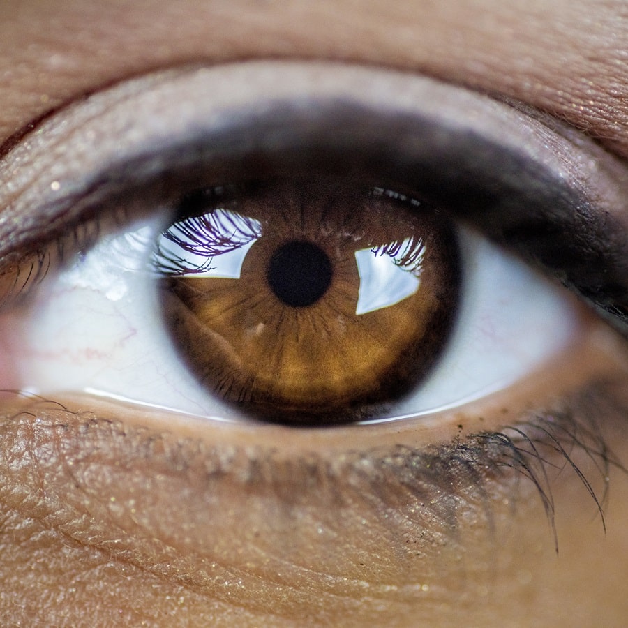 Does LASIK Surgery Permanently Fix your Eyes